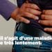 SANTE – Prévenir l&rsquo;insuffisance rénale