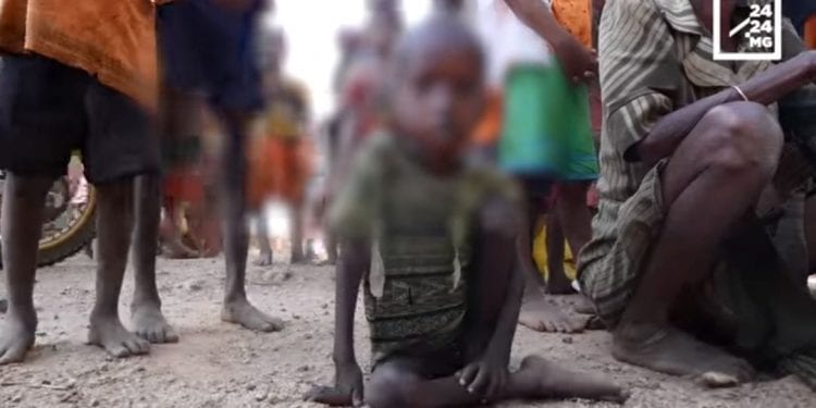 LUTTE CONTRE LA MALNUTRITION CHRONIQUE – Le professeur Hanta Marie Danielle Vololontiana plaide pour un changement des habitudes alimentaires