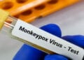 SANTE – L&rsquo;OMS déclenche son plus haut niveau d&rsquo;alerte mondiale face au virus Mpox ou la variole du singe